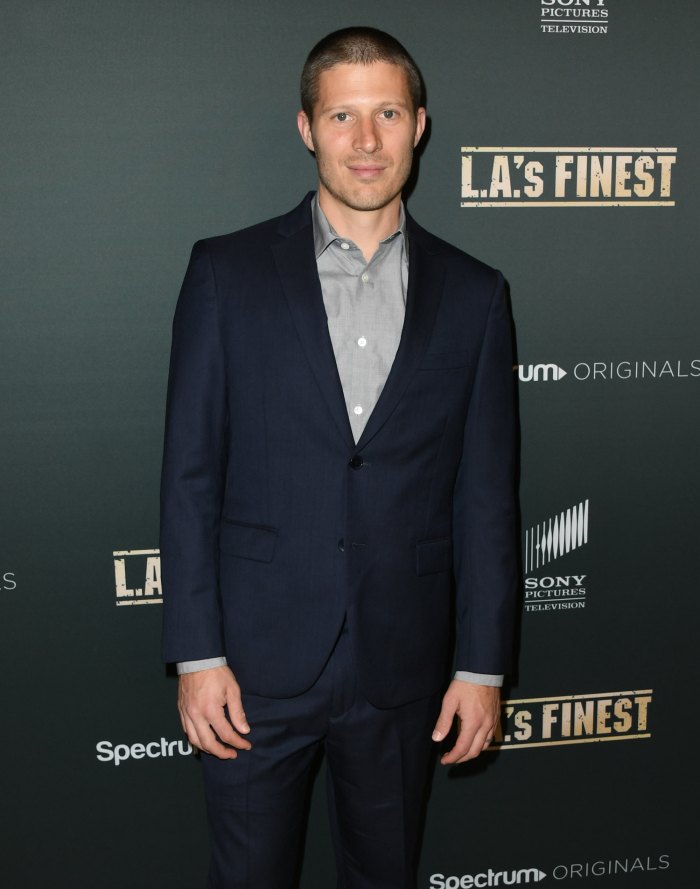 Zach Gilford Shares Shocking Photos of Face After Health Scare Us Weekly
