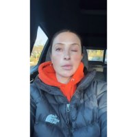 Bristol Palin reveals the paralysis of the face