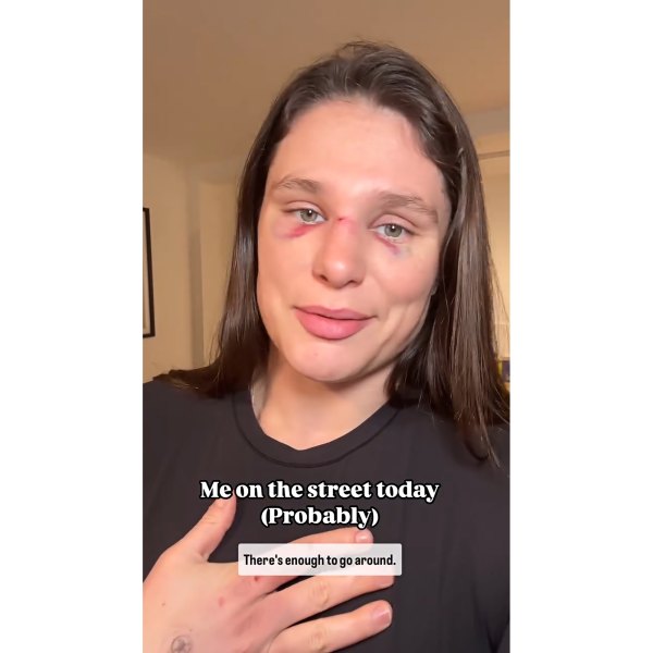 Ilona Maher Is ‘Truly Not OK’ After Breaking Nose in Rugby Match | Us ...