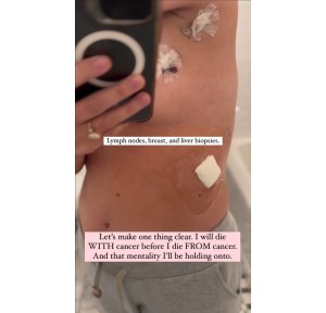 Katie Thurston Shares Candid Snap of Her Ports: ‘Will Die With Cancer Before I Die From Cancer’