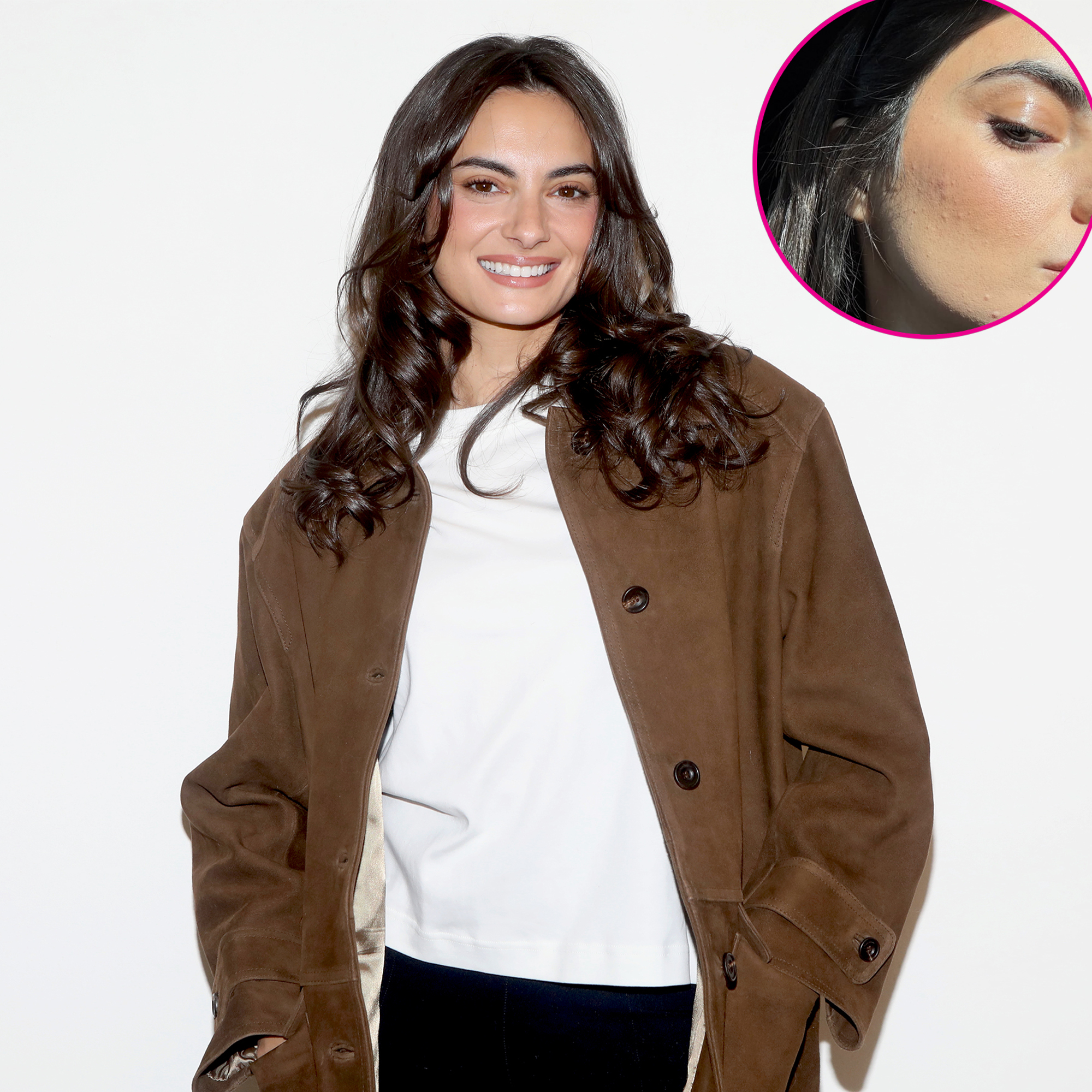 Paige DeSorbo Gives Realistic Look at Her Acne
