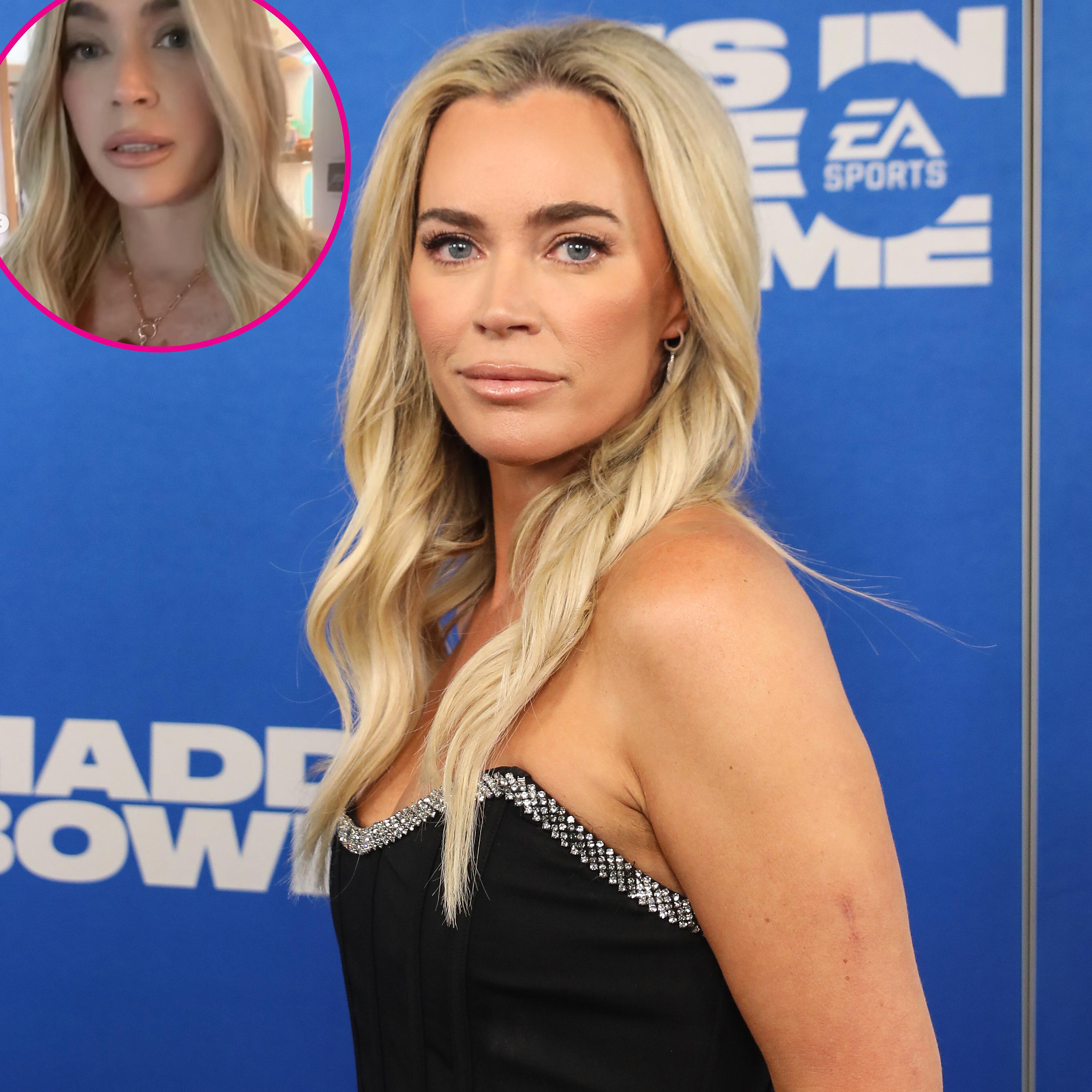 Teddi Mellencamp Debuts Blonde Wig Amid Cancer Treatment