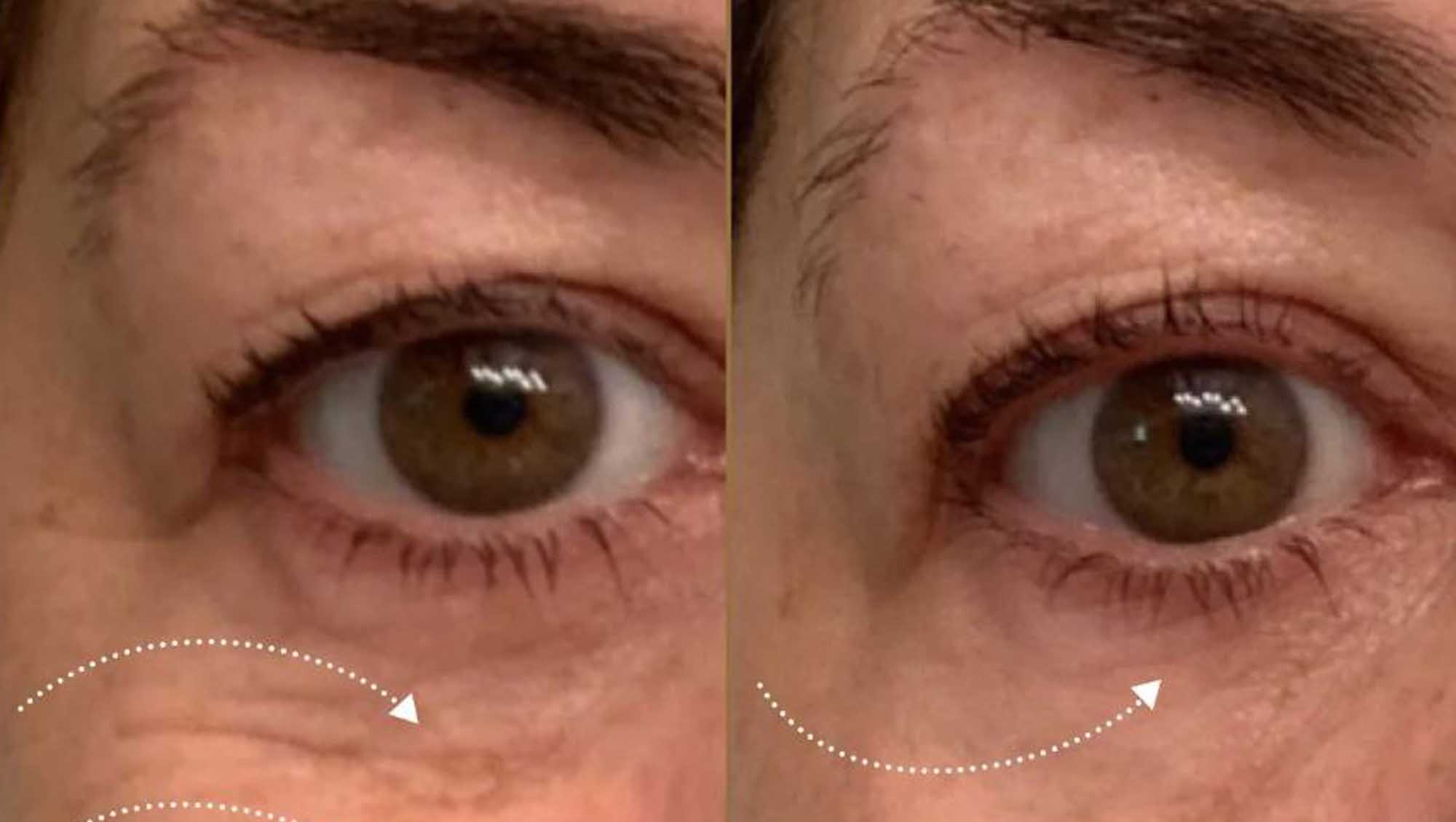 Biossance Eye Cream