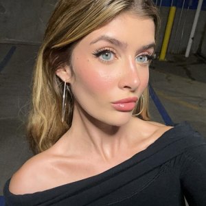 Sami Sheen Offers More Insight Into Plastic Surgery After Viral Video