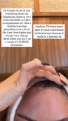 Chrissy Tigen shares an explanation for her mystery procedure