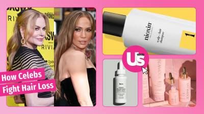 Celebrities With Hair Loss: How Hollywood Fights Balding | Us Weekly