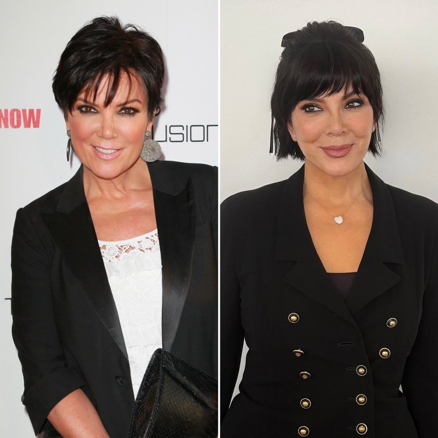 Every Time the Kardashians Revealed Their Surgery