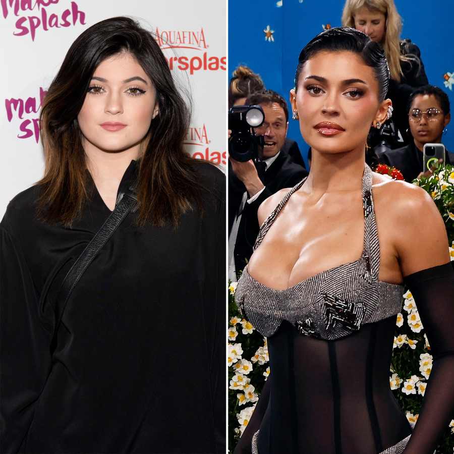 Every Time the Kardashians Revealed Their Surgery