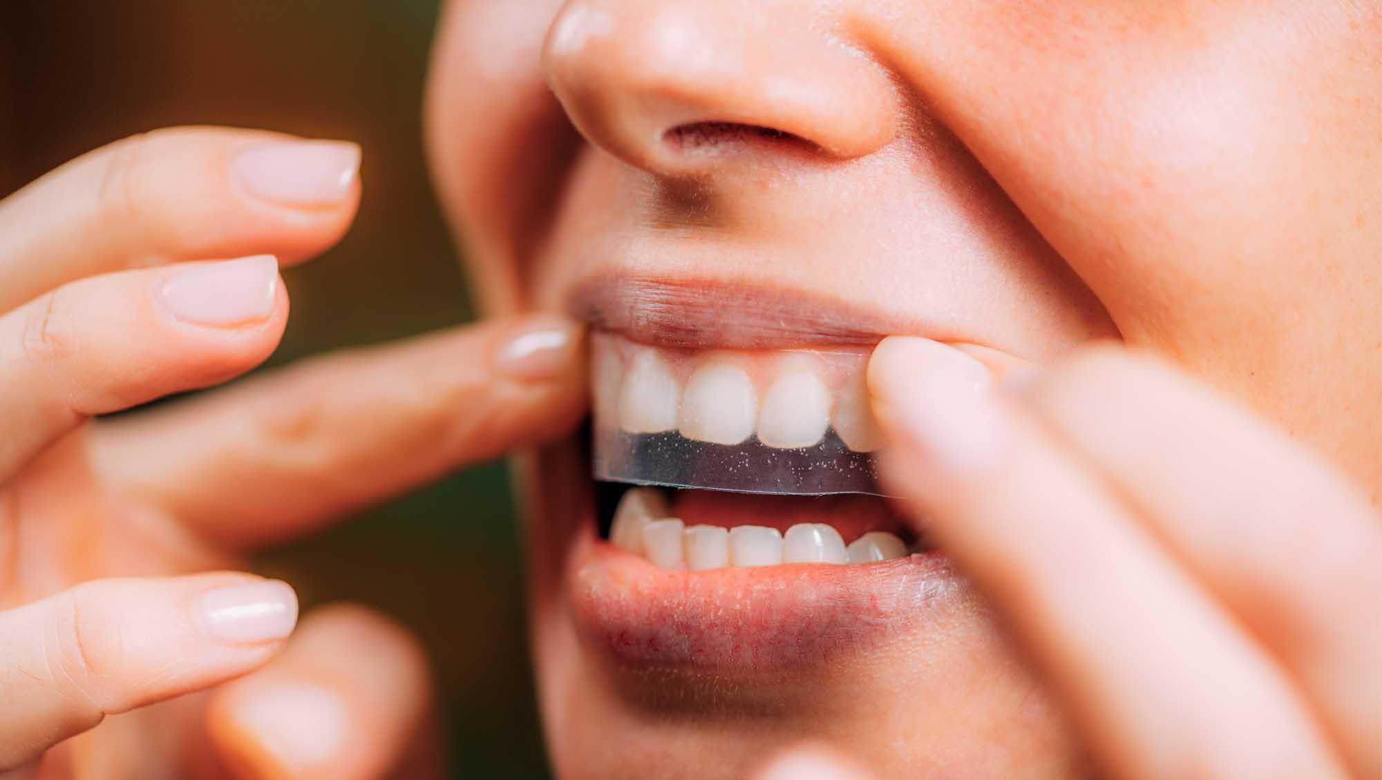 Teeth Whitening Strips