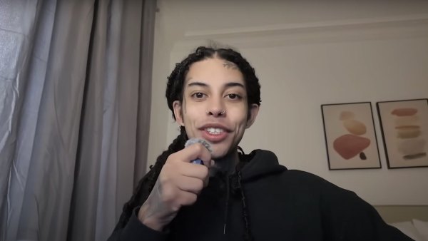 TikTok Star Alluringskull Shares Before and After Videos of Tongue-Splitting Cosmetic Procedure-3