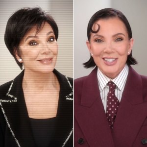 The Kardashians Season 7 Shows Before and After of Kris Jenner Facelift