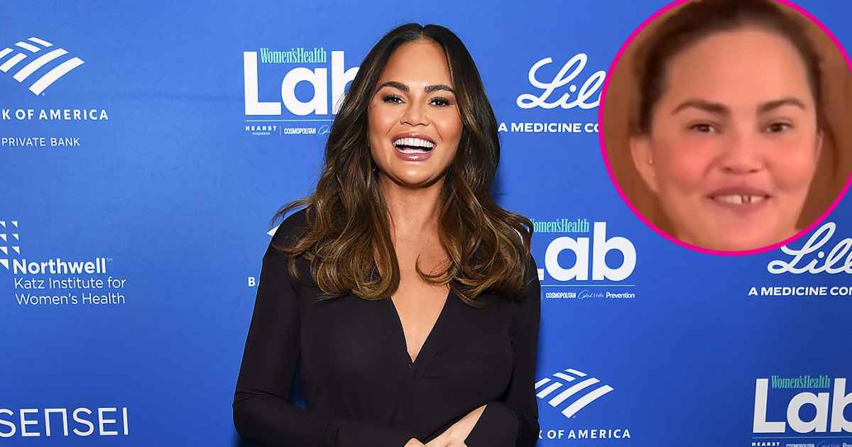 Chrissy Teigen, 사탕 지팡이 프로모션에서 앞니 훈련 Chrissy Teigen, 사탕 지팡이 프로모션에서 앞니 훈련