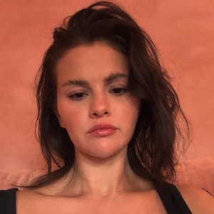Selena Gomez Laughs Off a Comment About Shaving Her ‘Mustache’: ‘It’s Melasma’