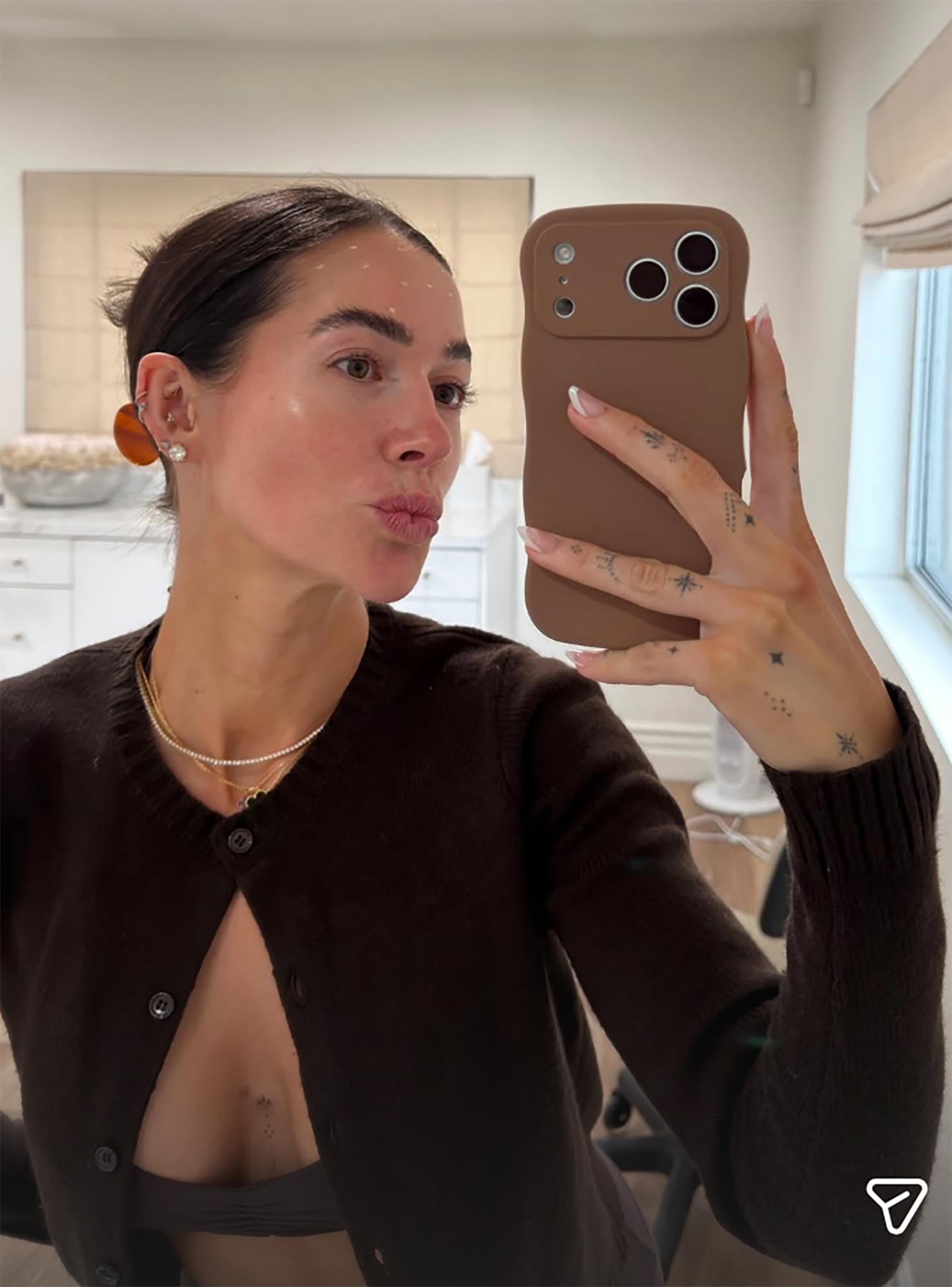 Avery Woods Gets Botox For 1st Time in a Year