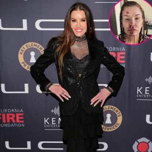 Feature Janice Dickenson Shares Photos From Brutal On Set Injury