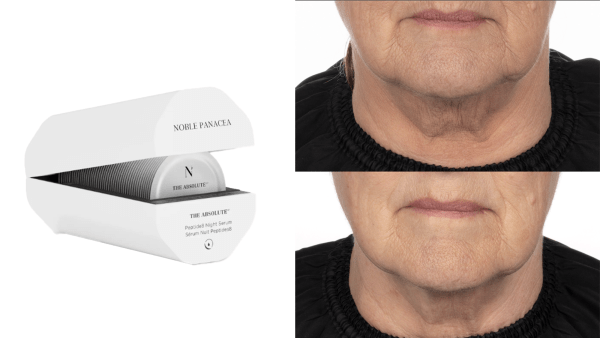 Noble Panacea Before and After