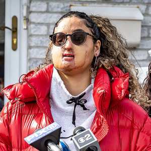 Police Make Arrest in 2021 Acid Attack that Left Long Island Woman Disfigured Nafiah Ikram