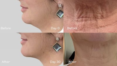 jaw