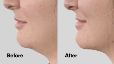 ShapeShift V-Line Jaw Defining Serum