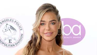 GettyImages-2236616681 denise richards before and after facelift