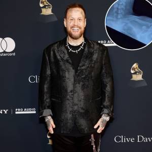 Promo Jelly Roll Reveals Secret Injury He Hid at the 2026 Grammys