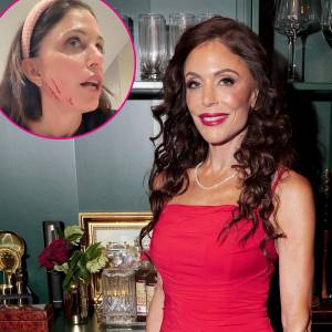 What Happened to Bethenny Frankels Face Nurse Jamie Controversy Explained