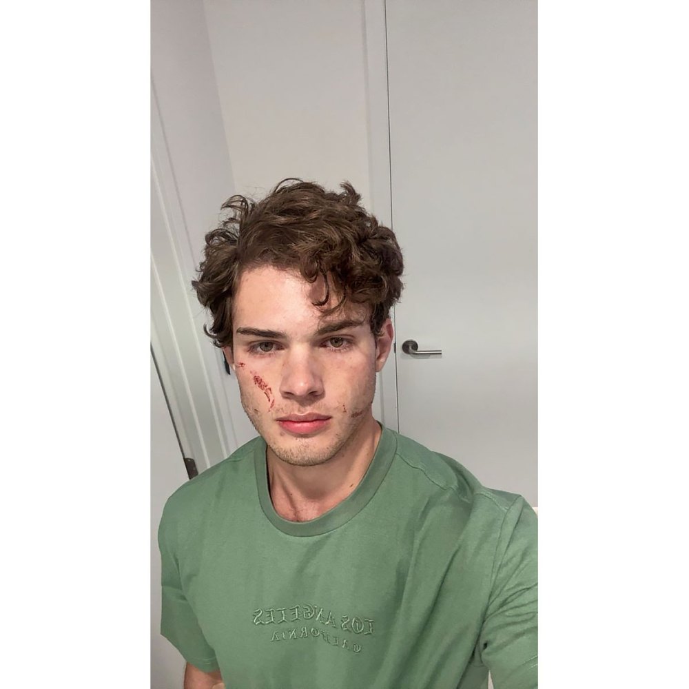 Clavicular Speaks Out