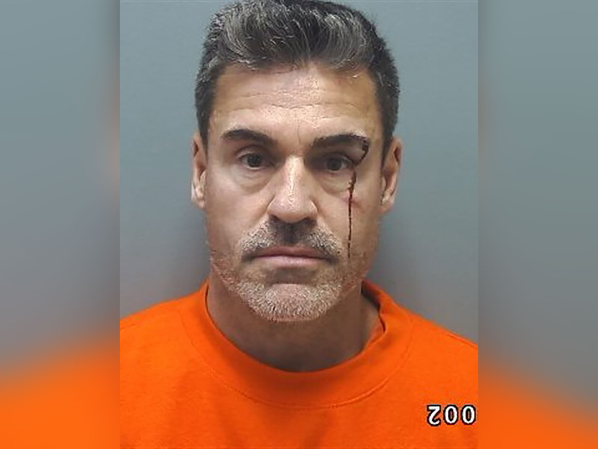 Lindsie Chrisley’s Boyfriend Had Blood Dripping Down His Face in Graphic Mugshot After Arrest