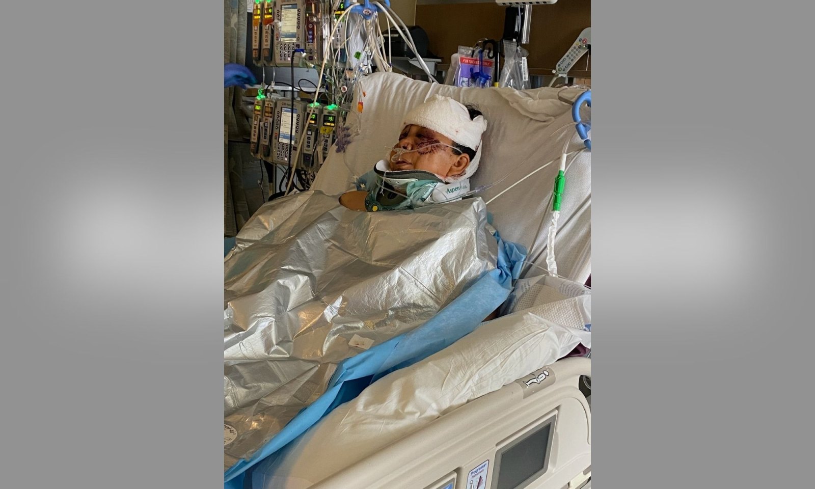 Woman in Critical Condition After Being Attacked By 3 Dogs