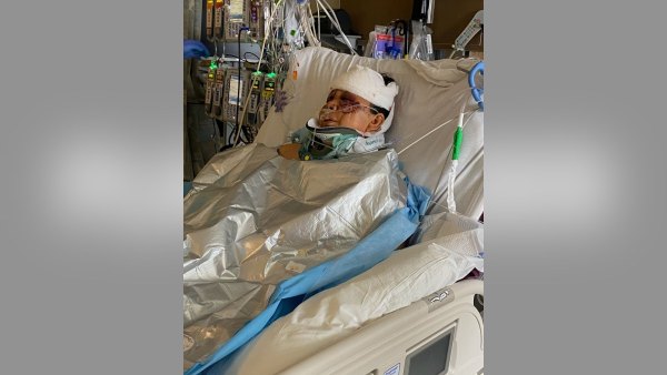 Colorado Woman Left in Critical Condition After Being Attacked By 3 Dogs Outside of Her Home