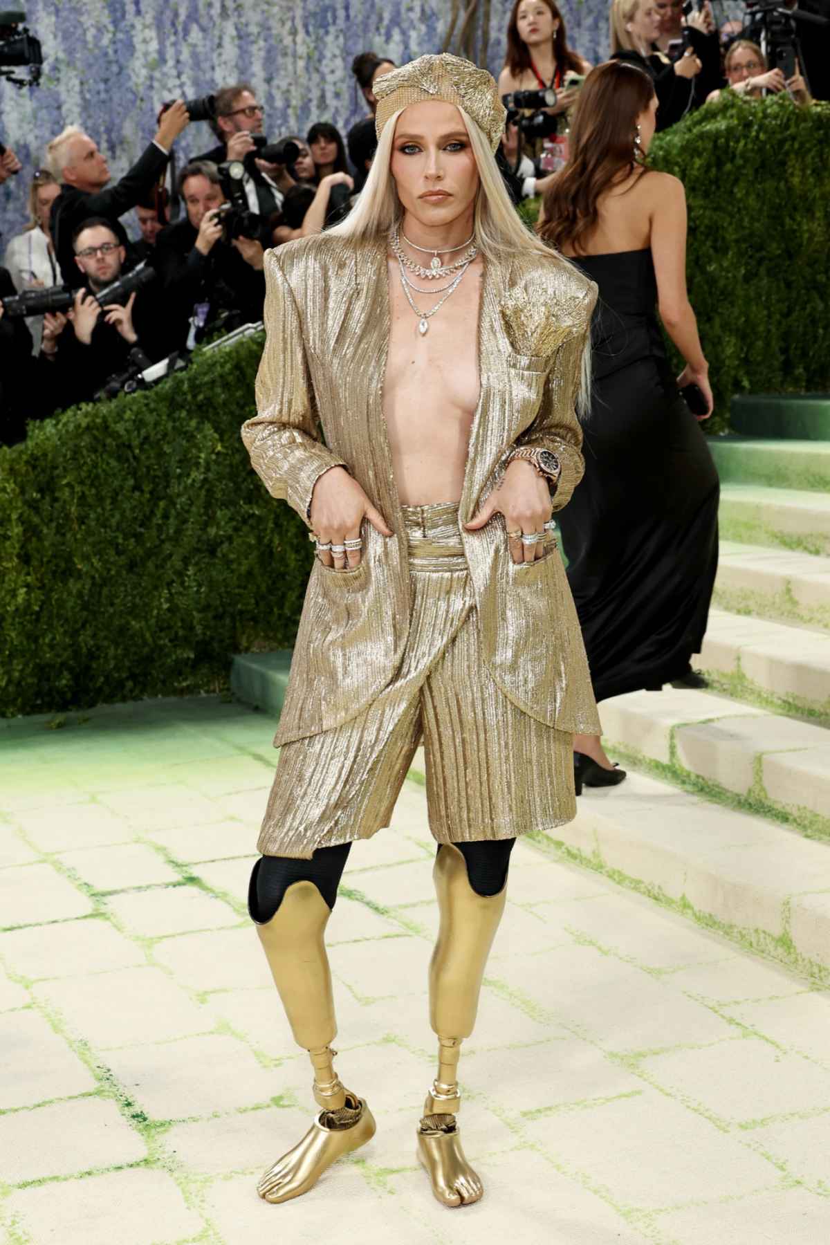 Lauren Wasser debuterer på Met-gallaen i gull: – Det var det mørkeste øyeblikket i livet mitt — image 2