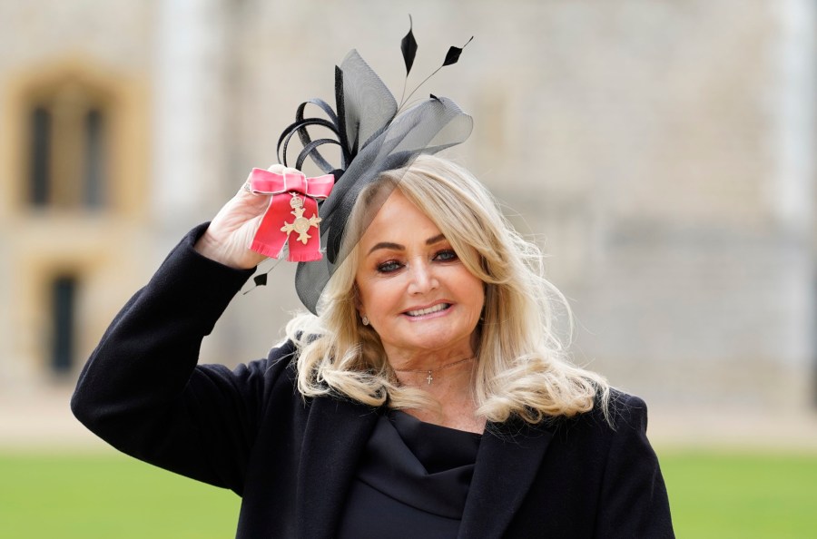 Singer Bonnie Tyler Is Recuperating After an Emergency Intestinal Surgery in Portugal Inline