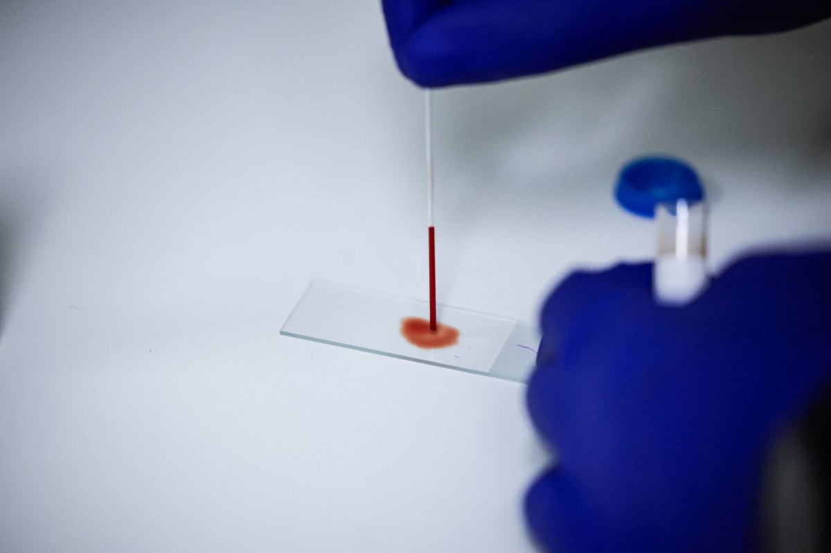 Getty Images 2279831686 Blood sample in lab