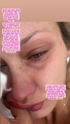 Bella Hadid Tears Up as She Details Chronic Illness With Lyme Disease