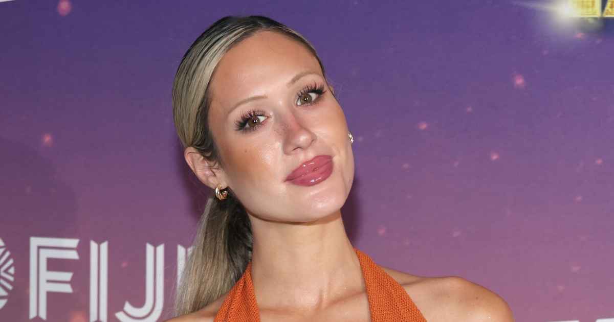 Former Bachelorette Rachel Recchia Reveals Breast Reduction Scars Nearly 2 Years Later Former Bachelorette Rachel Recchia Reveals Breast Reduction Scars Nearly 2 Years Later