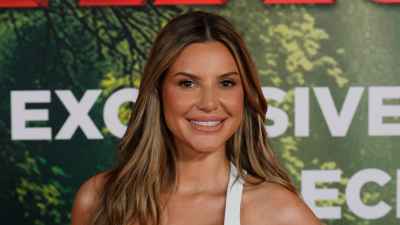 Love Island USA's Iris Kendall Addresses Plastic Surgery Rumors, What Work She's Really Had Done