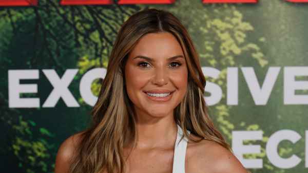 Love Island USA's Iris Kendall Addresses Plastic Surgery Rumors, What Work She's Really Had Done