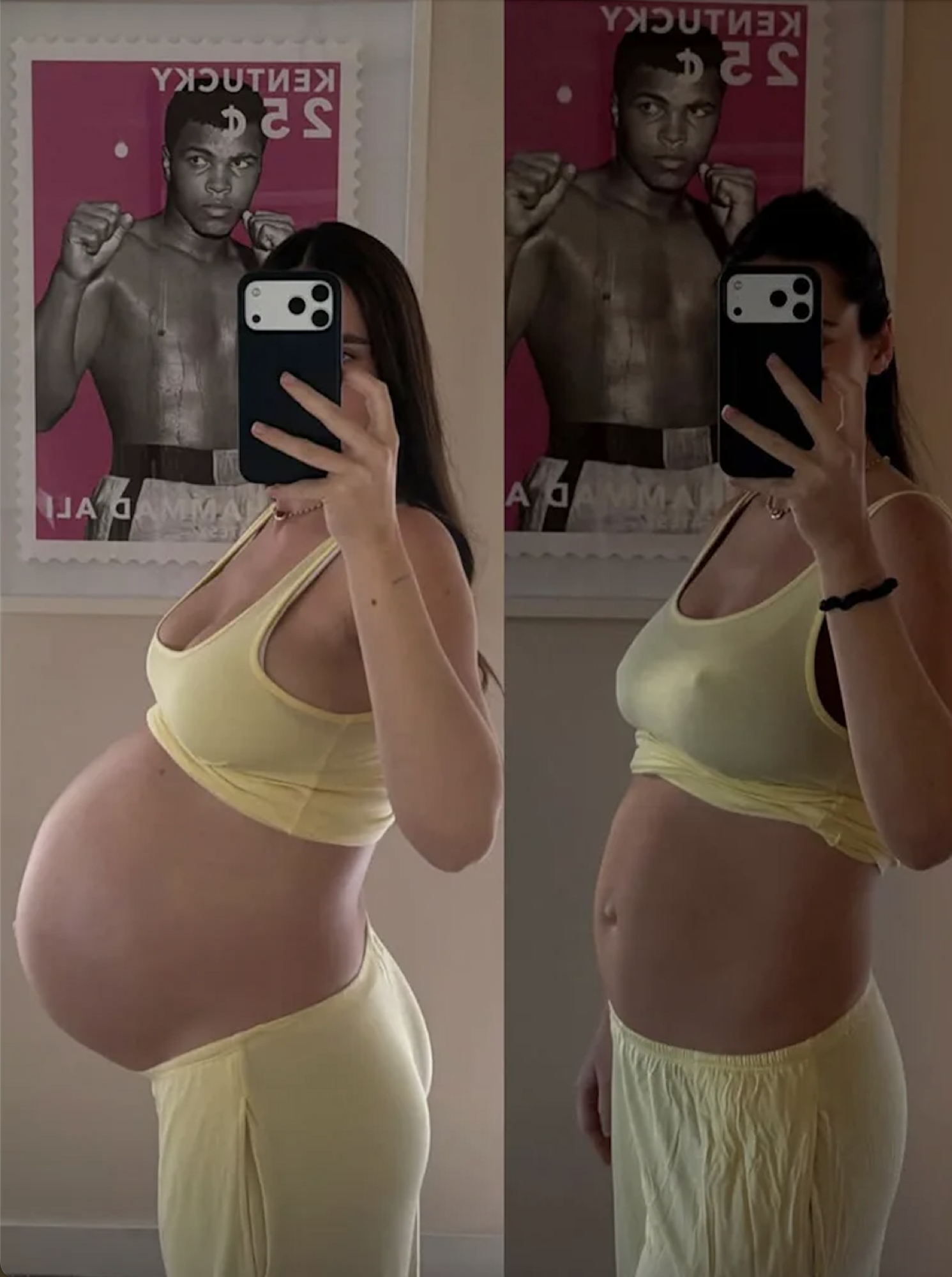 Nick Viall’s Wife Natalie Joy Details ‘Hard’ Postpartum Recovery After Twins