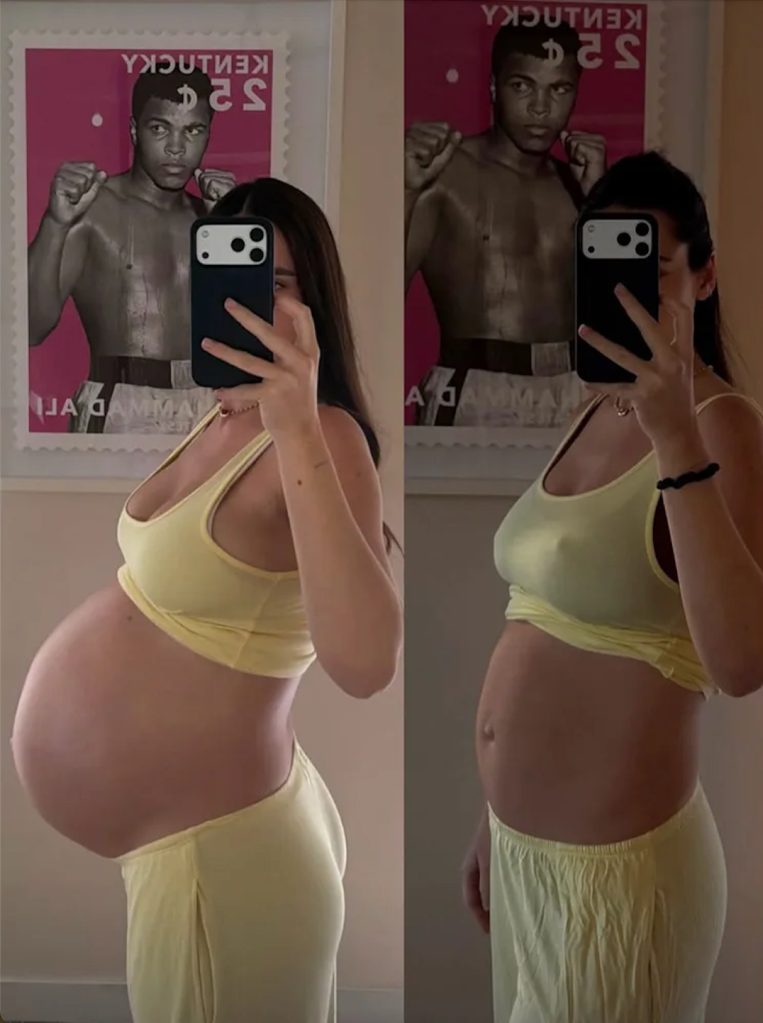 Nick Vialls Wife Natalie Joy Reflects on Incredibly Hard Postpartum Recovery After Welcoming Twins Before and After.