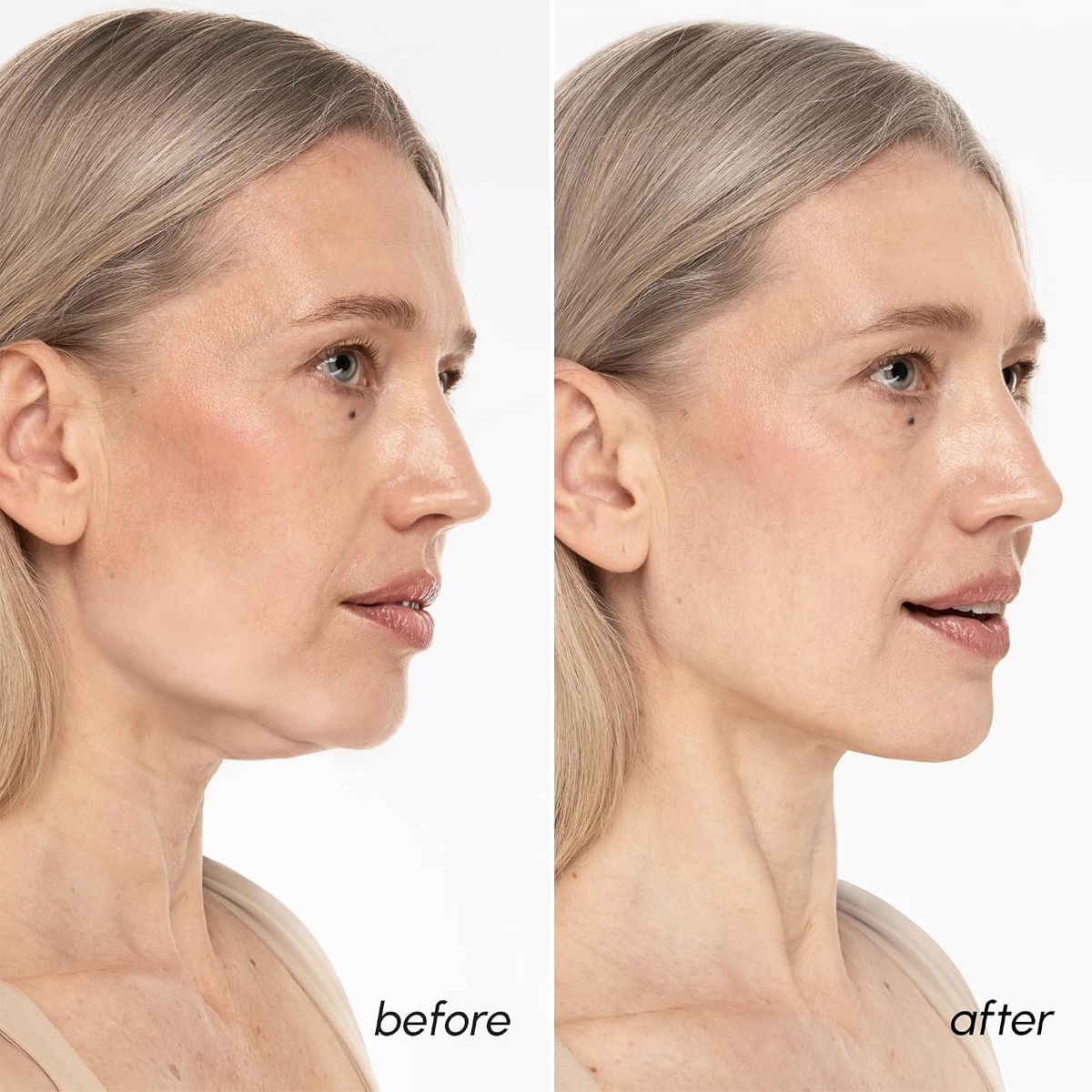 MAREE V Line Lifting Mask with 24K Gold