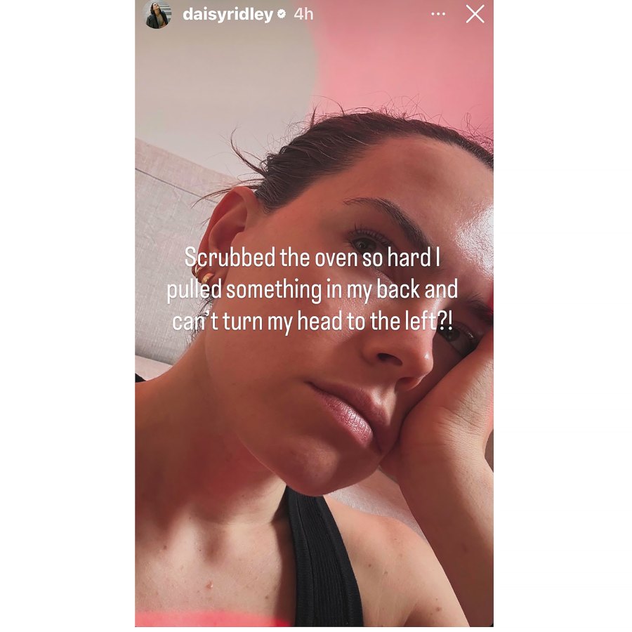 Daisy Ridley They Get Injuries From Household Tasks Just Like Us