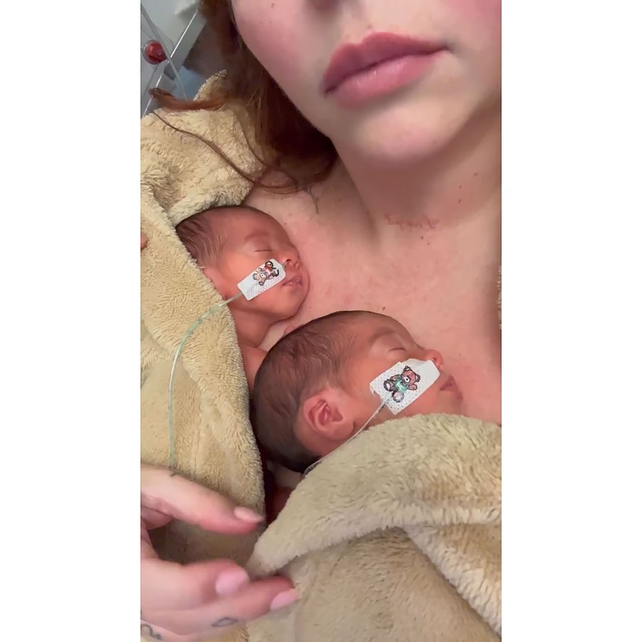 Jesy Nelson Shares Update on Twin Baby Girls Ahead of Surgery