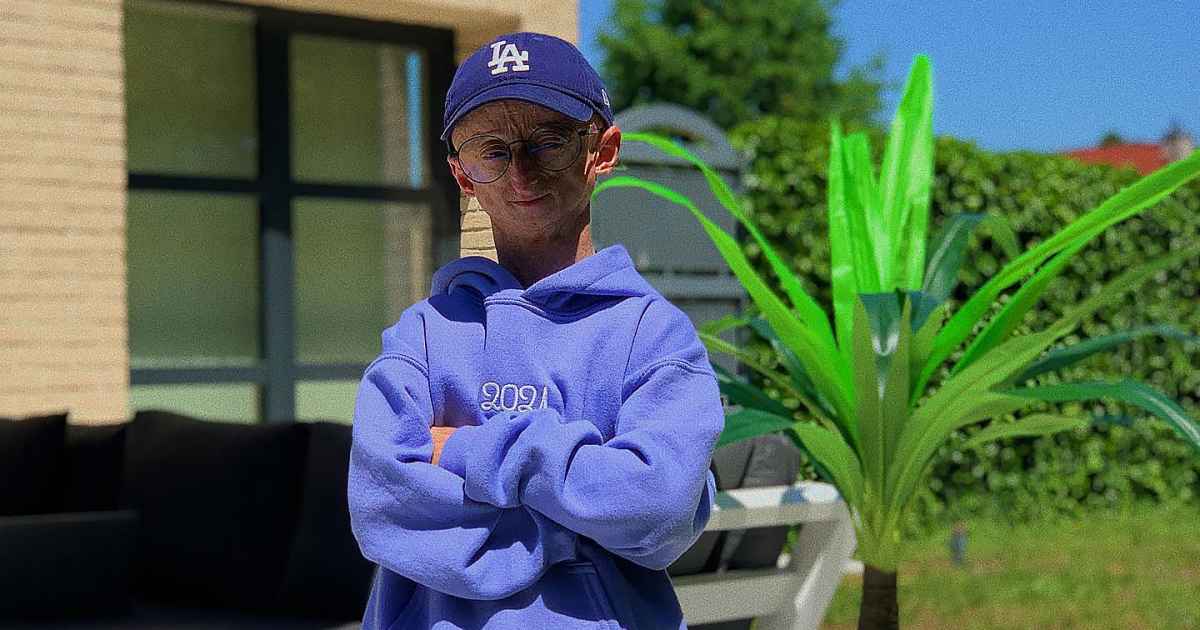 Influencer Michiel Vandeweert With Rare Genetic Disorder That Causes Rapid Aging Dies at Age 28 Influencer Michiel Vandeweert With Rare Genetic Disorder That Causes Rapid Aging Dies at Age 28