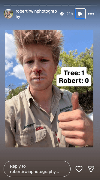 Screenshot-Robert-Irwins-Bloody-Nose-Injury-During-Crocodile-Research.png
