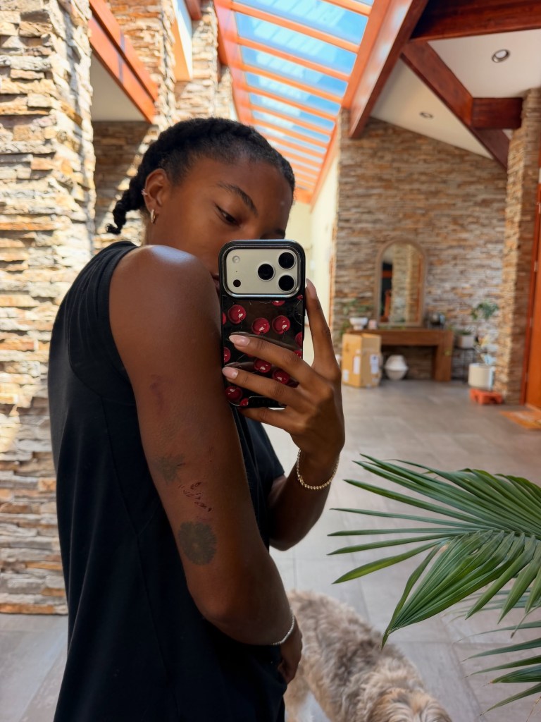 Olympic Gold Medalist Tara DavisWoodhall Shares Video From HeadOn Car Crash