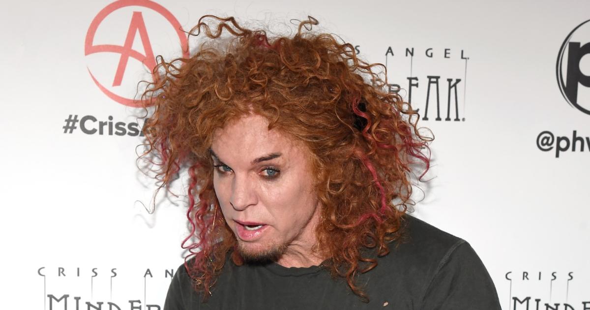 Carrot Top’s Rep Gives Update After Alleged Suicide Attempt Carrot Top’s Rep Gives Update After Alleged Suicide Attempt