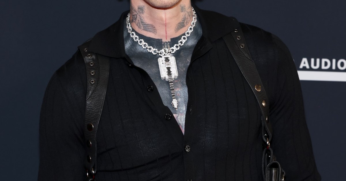 Machine Gun Kelly Shares Photo of Bloody Hand With Chunky Ring, Zooms In on Fresh Pimple Machine Gun Kelly Shares Photo of Bloody Hand With Chunky Ring, Zooms In on Fresh Pimple