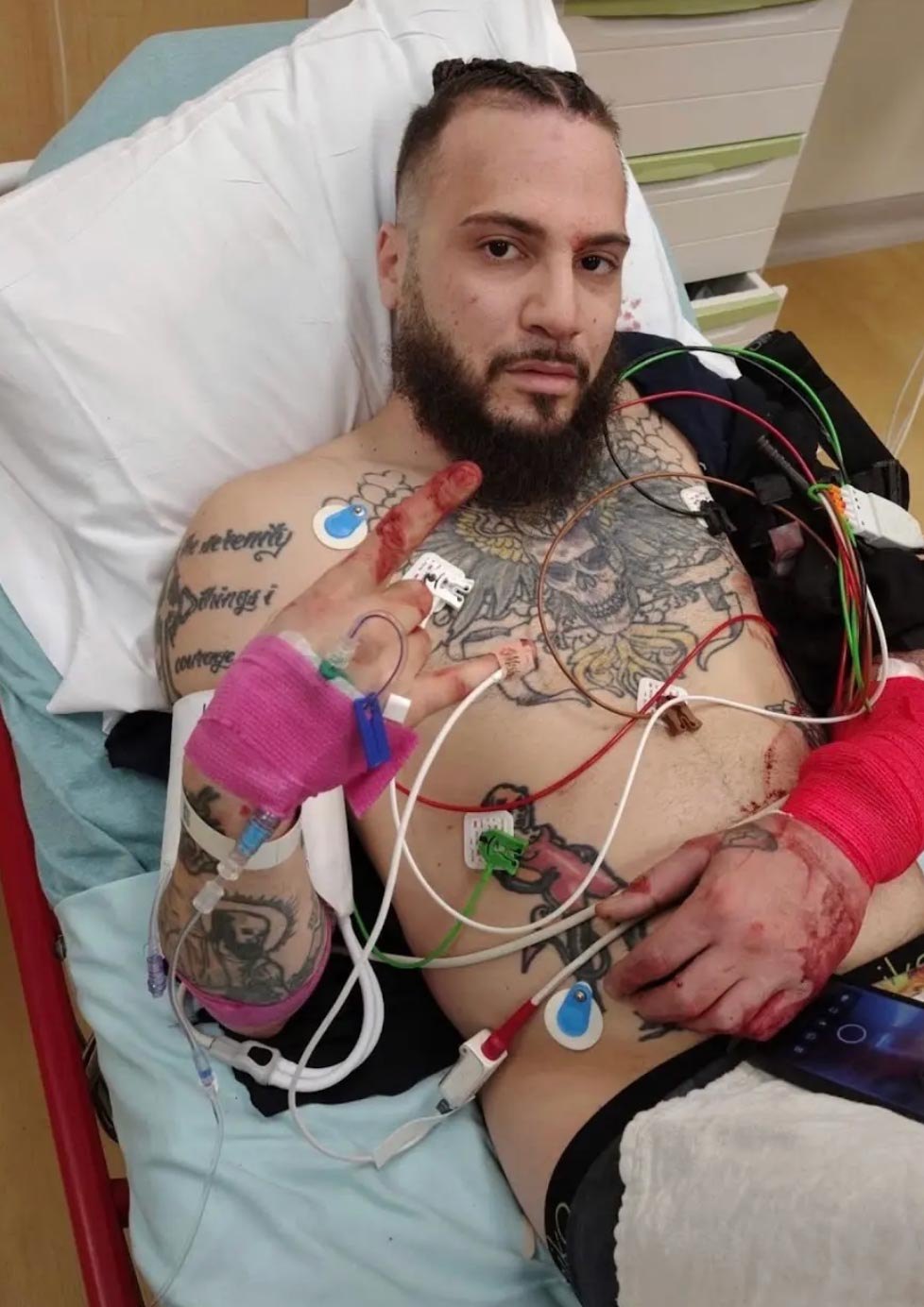 Influencer Charged After He Was Stabbed While Trying to Catch Alleged Child Predator