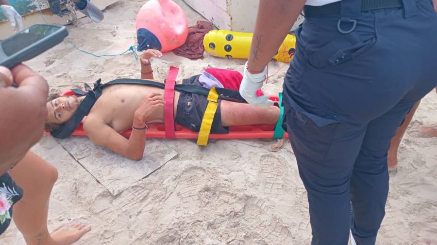Survivor Greece Star Sues Producers for $100 Million After Losing Leg