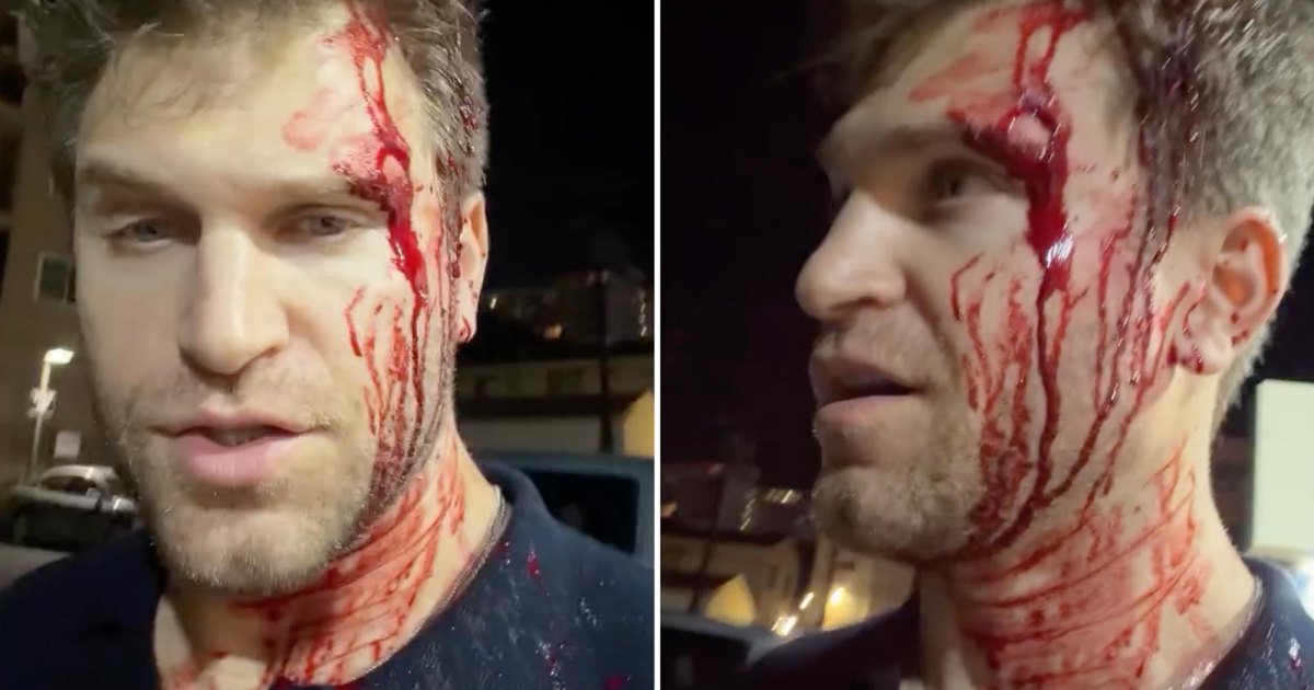 Pretty Little Liars Keegan Allen espancado e roubado à mão armada